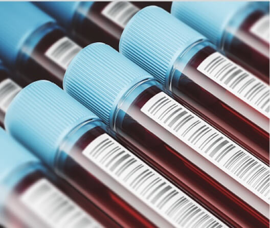 Vials of blood stacked on top of and beside each other with bar codes on them.