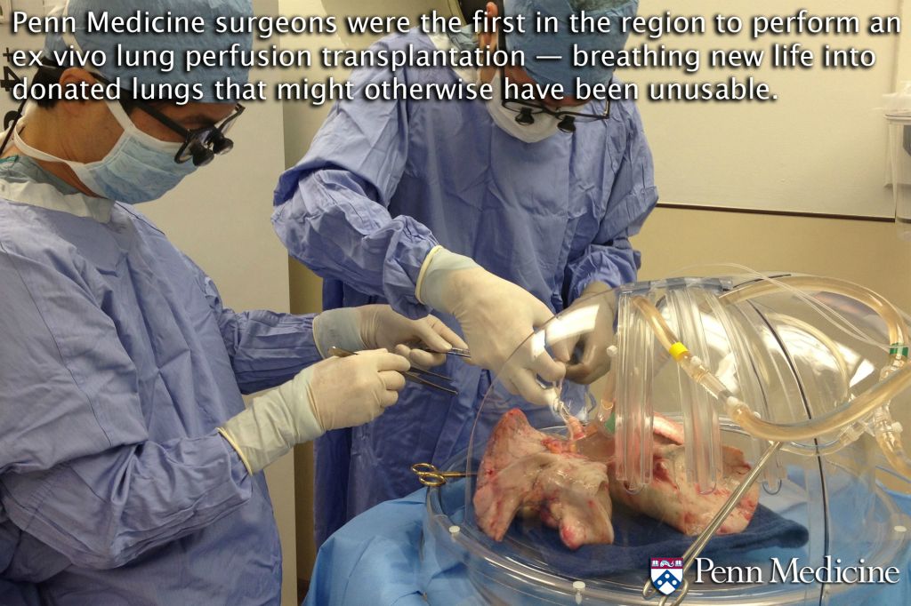 Penn Medicine surgeons were the first in the Northeast to implant a temporary total artificial heart in a patient waiting for a heart transplant.
