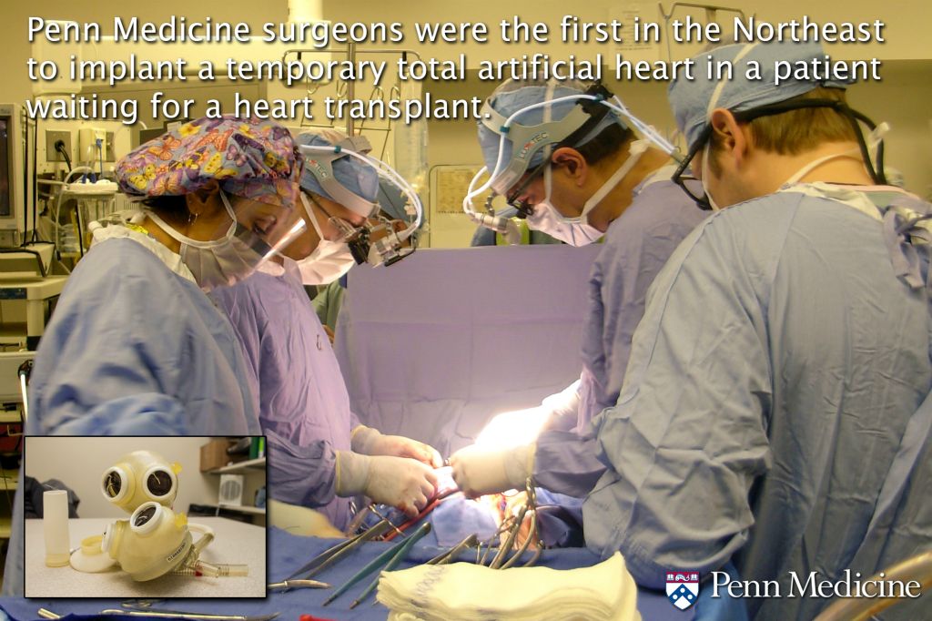 Penn Medicine surgeons were the first in the Northeast to implant a temporary total artificial heart in a patient waiting for a heart transplant.