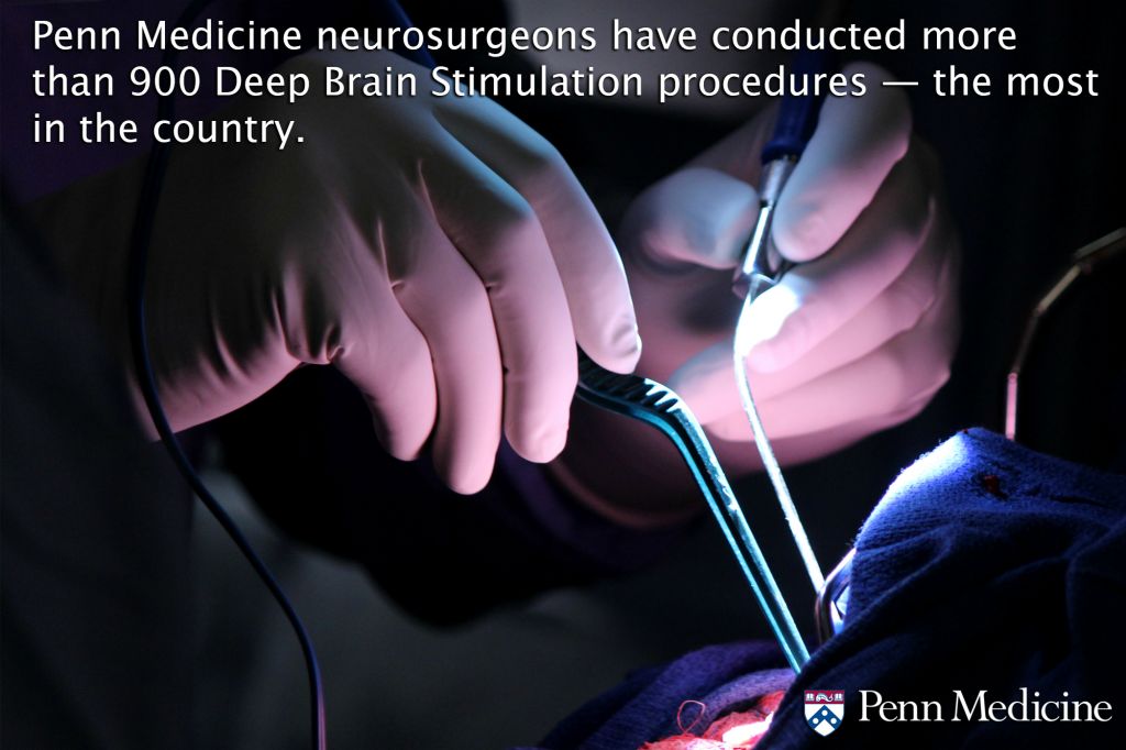 Penn Medicine neurosurgeons have conducted more than 900 Deep Brain Stimulation procedures — the most in the country. The procedure is typically utilized on patients with Parkinson's disease, as well as clinical trial participants with other mental health and neurodegenerative disorders.